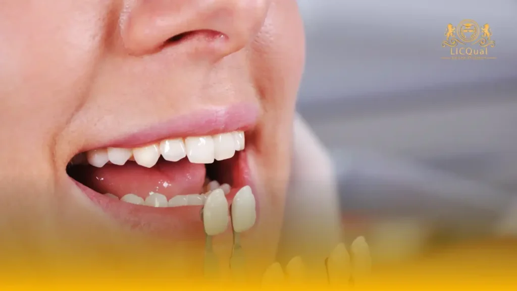 LICQual Level 3 Certificate in Aesthetic Dentistry 12 LICQual Level 3 Certificate in Aesthetic Dentistry