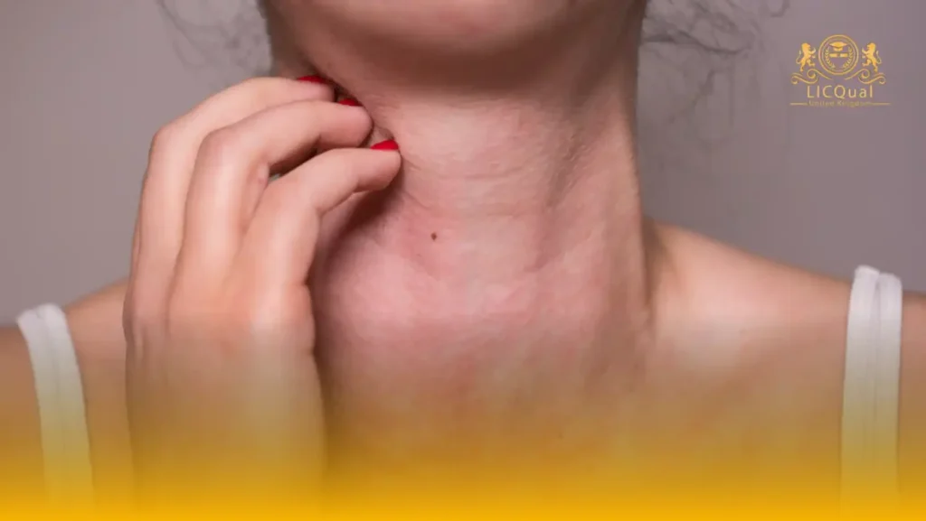 LICQual Level 3 Certificate in Allergy and Immunology (Cert AI) 103 LICQual Level 3 Certificate in Allergy and Immunology (Cert AI)