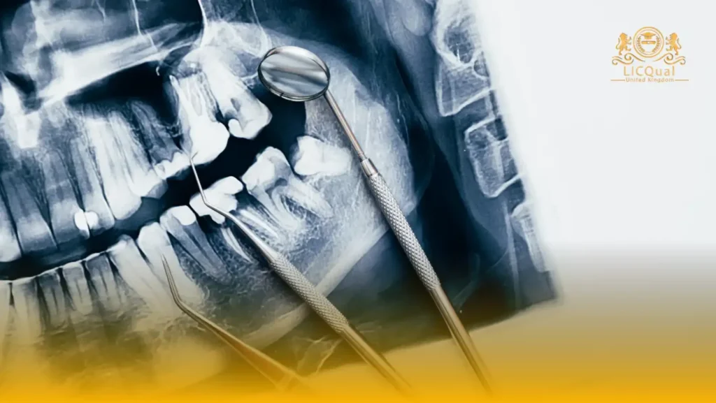 LICQual Level 3 Diploma in Dental Radiology 29 LICQual Level 3 Diploma in Dental Radiology