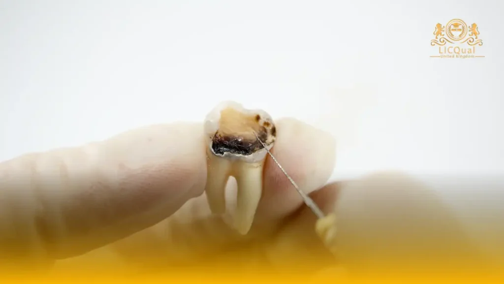 LICQual Level 3 Diploma in Endodontics