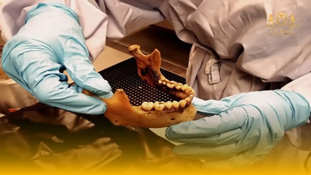 LICQual Level 6 Diploma in Forensic Odontology (Dip Forensic Odontology) 63 LICQual Level 6 Diploma in Forensic Odontology (Dip Forensic Odontology)