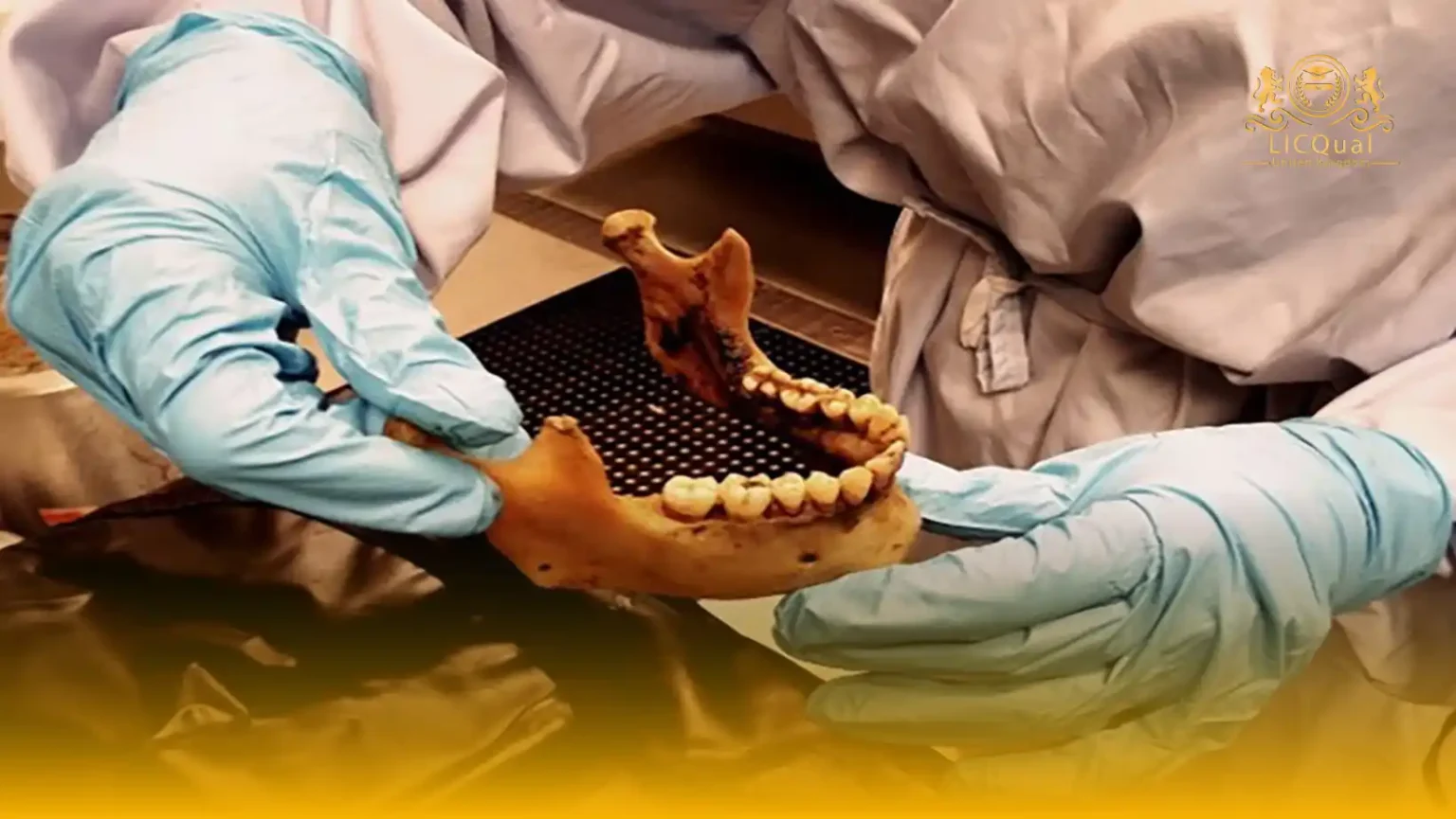 LICQual Level 6 Diploma in Forensic Odontology (Dip Forensic Odontology) 