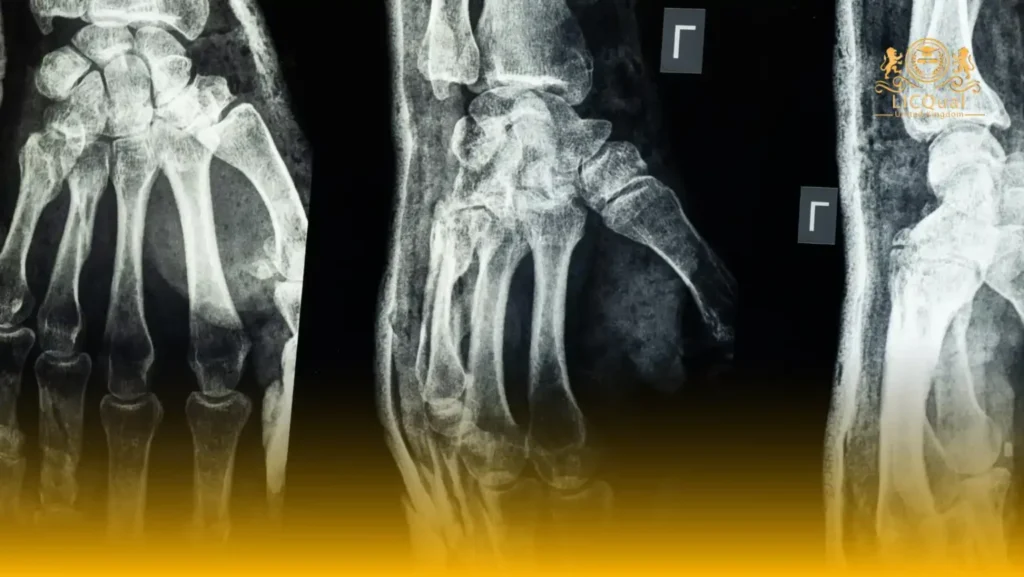 LICQual Level 7 Postgraduate Diploma in Radiology (PgDRD) 240 LICQual Level 7 Postgraduate Diploma in Radiology (PgDRD)